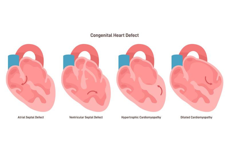 Congenital Heart Disease Treatment